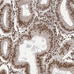 FLJ10154 Antibody, Novus Biologicals:Antibodies:Primary Antibodies